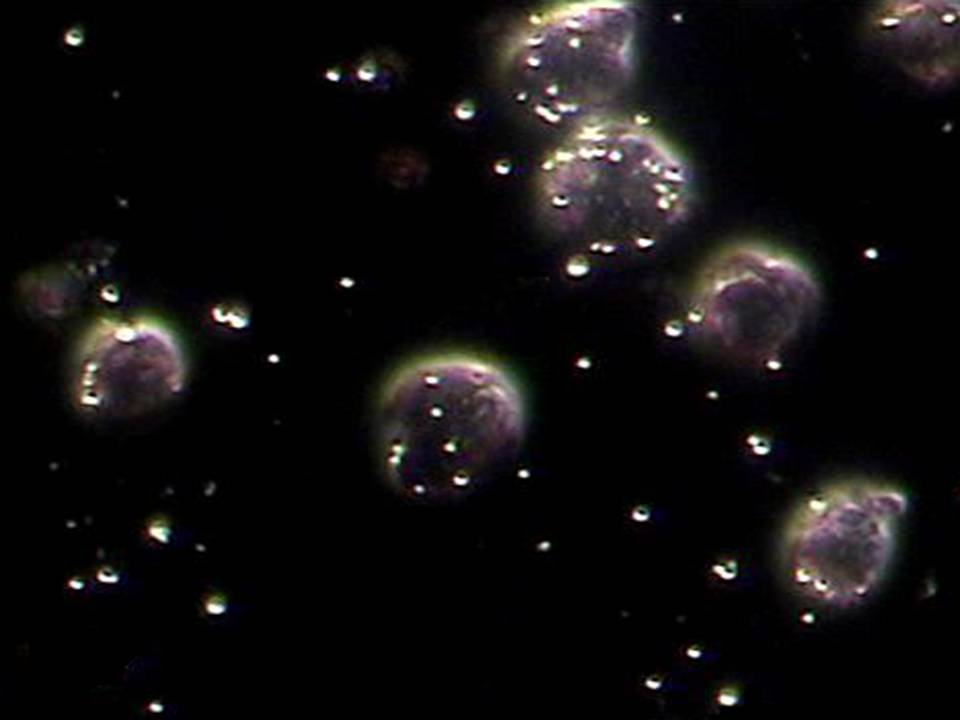 Biotinylated cationic microbubbles attached on cells x40 magnification Biotinylated cationic microbubbles attached on cells x40 magnification